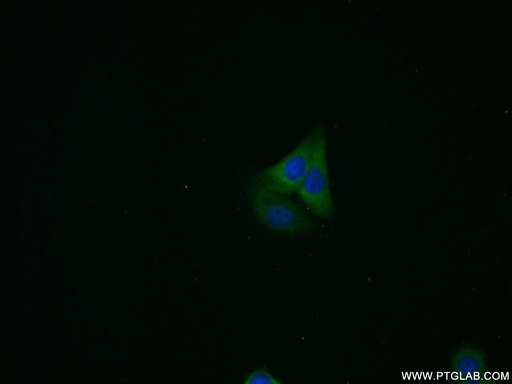 [12937-2-AP-20UL] PSME2 Polyclonal antibody