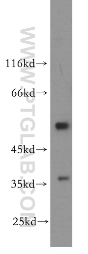 [12939-1-AP-150UL] IFRD1 Polyclonal antibody