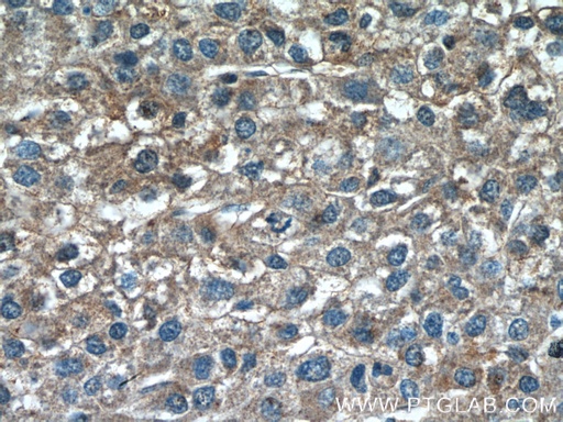 [12940-1-AP-150UL] TSSK3 Polyclonal antibody