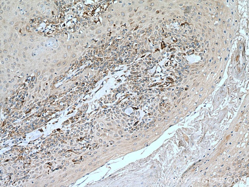 [12943-1-AP-20UL] SLC27A3 Polyclonal antibody