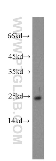 [12944-1-AP-150UL] GCAP1 Polyclonal antibody