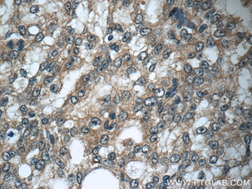 [12945-1-AP-150UL] GAGE7 Polyclonal antibody
