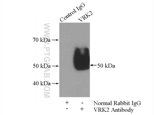 [12946-1-AP-150UL] VRK2 Polyclonal antibody
