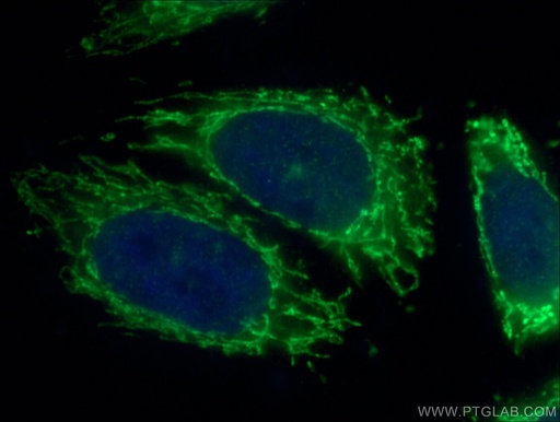 [12949-1-AP-150UL] PDK4 Polyclonal antibody