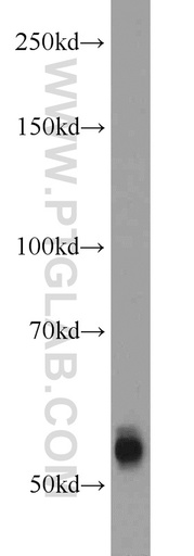 [12950-1-AP-150UL] TMPRSS6 Polyclonal antibody