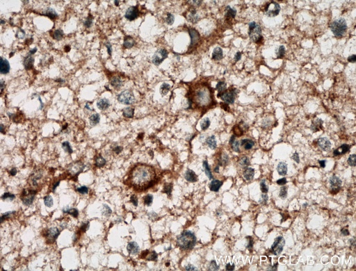 [12953-1-AP-150UL] CA10 Polyclonal antibody