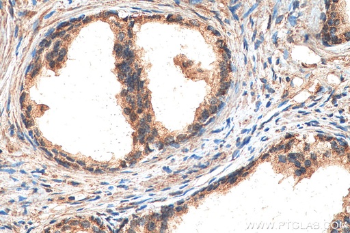 [12955-1-AP-20UL] ILK Polyclonal antibody