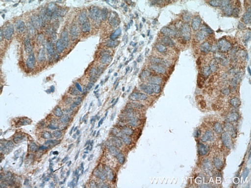 [12956-1-AP-150UL] LIPA Polyclonal antibody