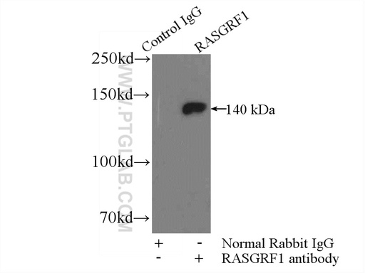 [12958-1-AP-150UL] RASGRF1 Polyclonal antibody