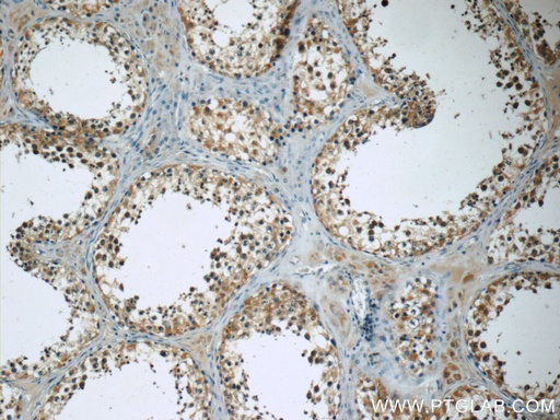 [12959-1-AP-150UL] TEKT3 Polyclonal antibody