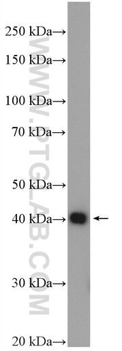 [12963-1-AP-20UL] CHAD Polyclonal antibody