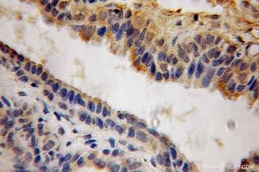 [12965-1-AP-20UL] ACP6 Polyclonal antibody