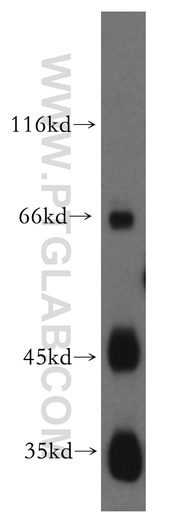 [12972-1-AP-150UL] JAM2 Polyclonal antibody