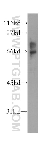 [12975-1-AP-150UL] EME1 Polyclonal antibody