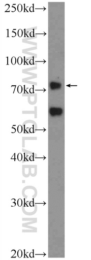 [12976-1-AP-150UL] PASD1 Polyclonal antibody