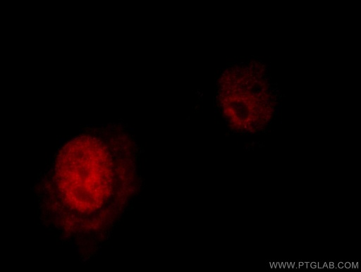 [12981-1-AP-20UL] NFYA Polyclonal antibody
