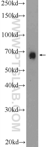 [12986-1-AP-150UL] BNIP3L Polyclonal antibody