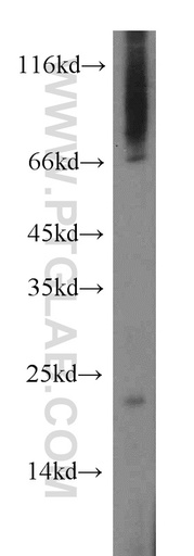 [12988-1-AP-20UL] ARMER Polyclonal antibody