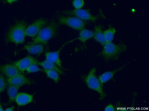 [12989-1-AP-150UL] GSPT2 Polyclonal antibody