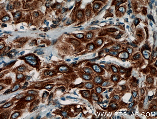 [12990-1-AP-150UL] PGRMC1 Polyclonal antibody