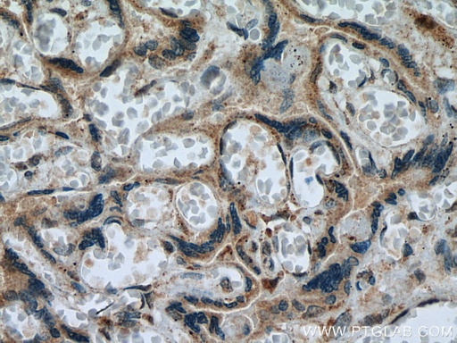 [12995-1-AP-150UL] NEU4 Polyclonal antibody