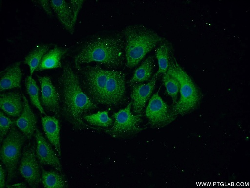 [12998-1-AP-150UL] NF-L Polyclonal antibody