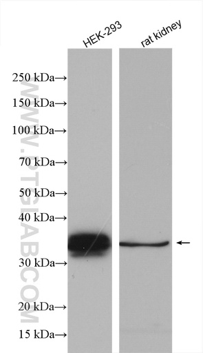 [12999-1-AP-150UL] Ephrin B1 Polyclonal antibody