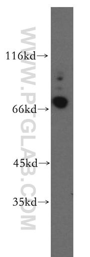 [13001-1-AP-150UL] CRTAC1 Polyclonal antibody