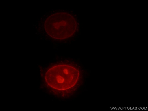 [13010-1-AP-150UL] RPIA Polyclonal antibody