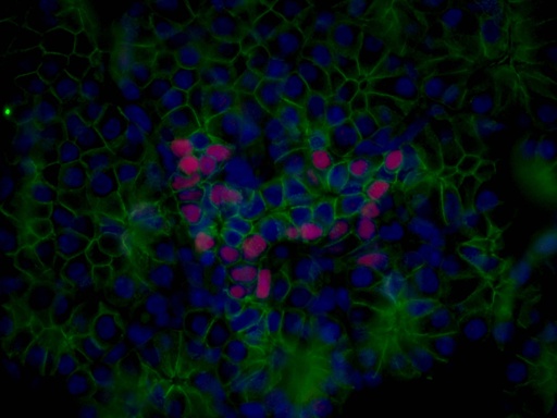[13013-1-AP-150UL] NKX2-2 Polyclonal antibody