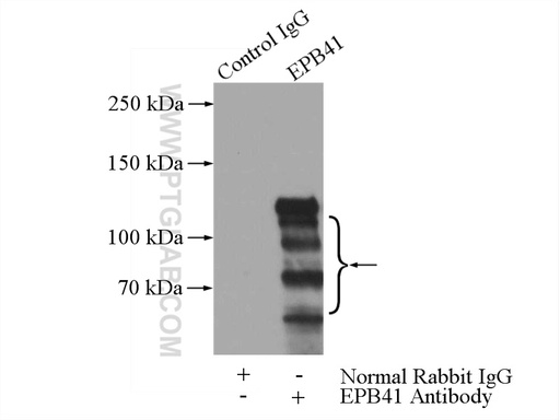 [13014-1-AP-150UL] EPB41 Polyclonal antibody