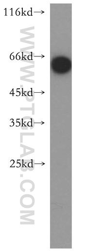 [13021-1-AP-20UL] ENTPD3 Polyclonal antibody