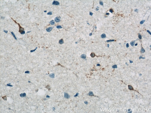 [13023-1-AP-20UL] RRAGB Polyclonal antibody