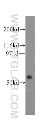 [13024-1-AP-20UL] FBX15 Polyclonal antibody