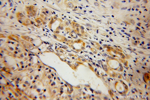 [13027-1-AP-20UL] ELMOD2 Polyclonal antibody