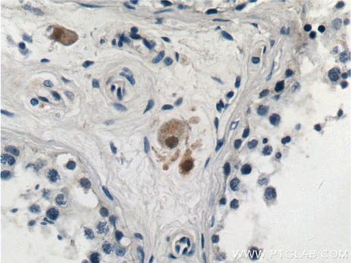 [13028-1-AP-20UL] STAT4 Polyclonal antibody