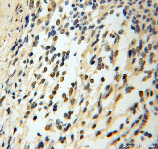 [13030-1-AP-20UL] CHTF18 Polyclonal antibody