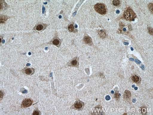 [13032-1-AP-20UL] HuA/B/C/D Polyclonal antibody