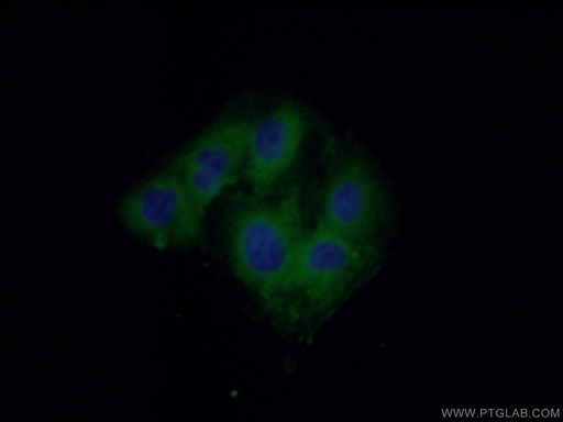 [13033-1-AP-20UL] SACM1L Polyclonal antibody