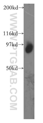 [13034-1-AP-150UL] TGS1 Polyclonal antibody