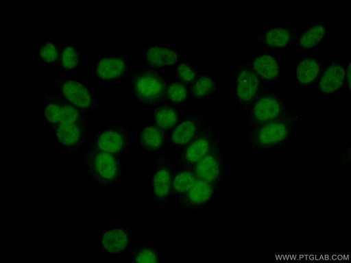 [13035-1-AP-20UL] RAD9A Polyclonal antibody