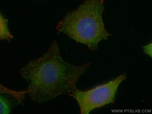 [13037-1-AP-150UL] TRIM37 Polyclonal antibody