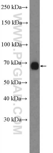 [13039-1-AP-20UL] CACNB1 Polyclonal antibody