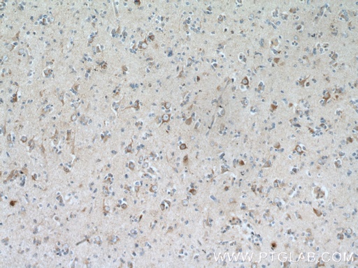 [13040-1-AP-20UL] GRID1 Polyclonal antibody