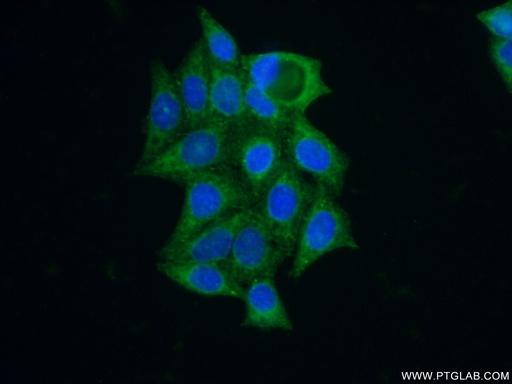 [13044-1-AP-20UL] GNS Polyclonal antibody