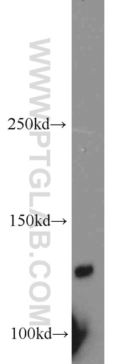 [13045-1-AP-20UL] PLEKHA5 Polyclonal antibody