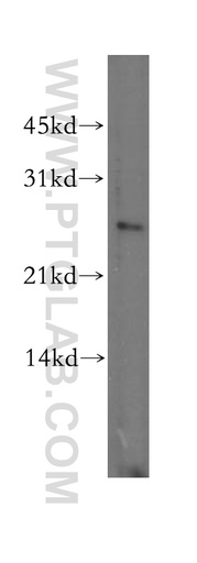 [13046-1-AP-20UL] DLX1 Polyclonal antibody