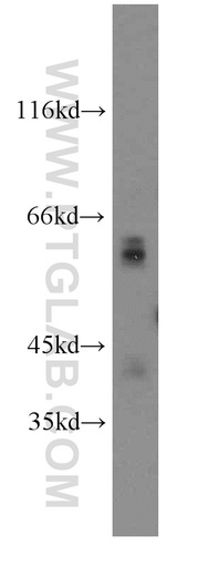 [13048-1-AP-20UL] Glypican 4 Polyclonal antibody