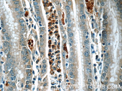 [13049-1-AP-20UL] ARL8B Polyclonal antibody
