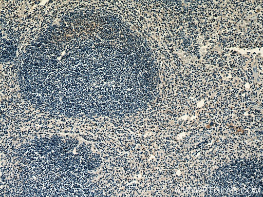 [13051-1-AP-20UL] RAB37 Polyclonal antibody